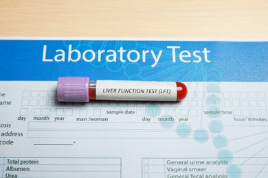 Liver Function Test. Tube with blood sample and laboratory form on wooden table, above view