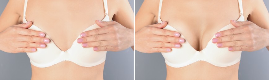 Image of Breast augmentation with silicone implants. Collage with photos of woman before and after plastic surgery against grey background, closeup