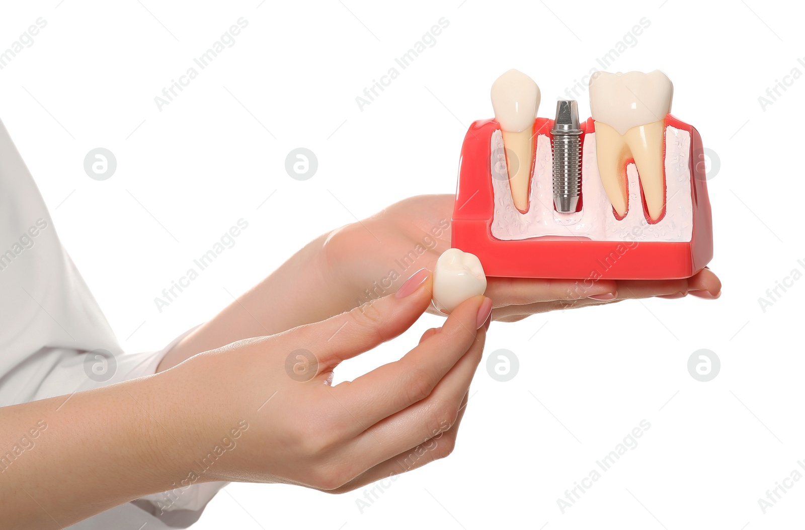 Photo of Dentist holding educational model of dental implant on white background, closeup