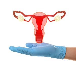 Image of Doctor demonstrating virtual icon with illustration of female reproductive system on white background, closeup. Gynecological care 