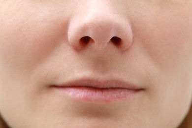 Photo of Woman with dry skin, closeup of mouth