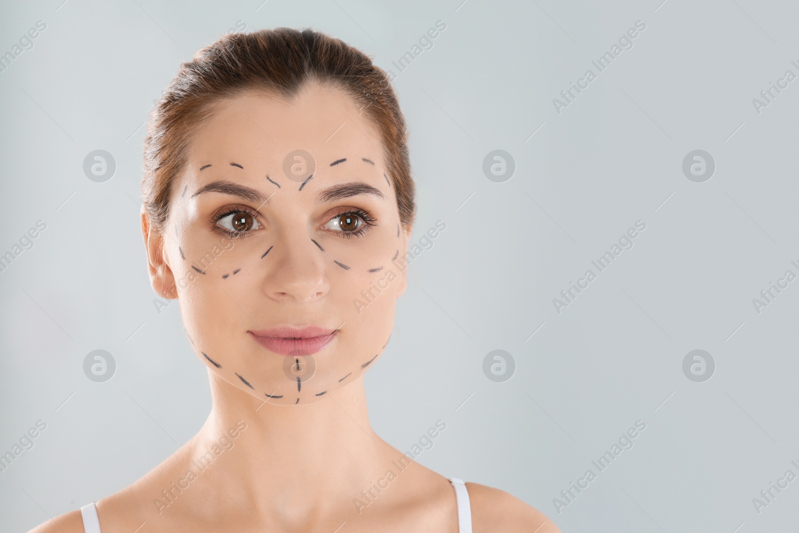 Photo of Portrait of woman with marks on face against grey background, space for text. Cosmetic surgery