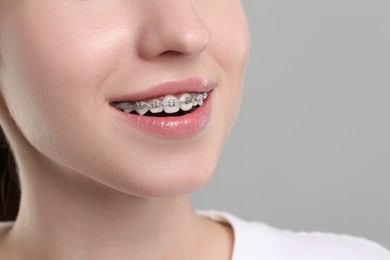 Photo of Smiling woman with dental braces on grey background, closeup. Space for text