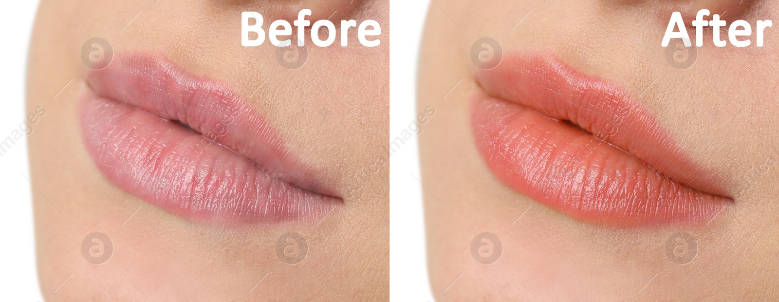 Image of Collage with photos of young woman before and after permanent lip makeup, closeup. Banner design