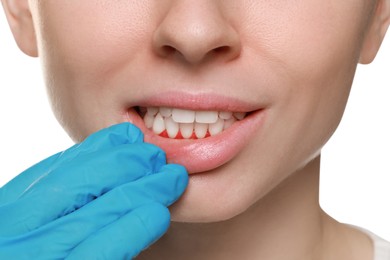 Doctor examining woman's inflamed gum on white background, closeup