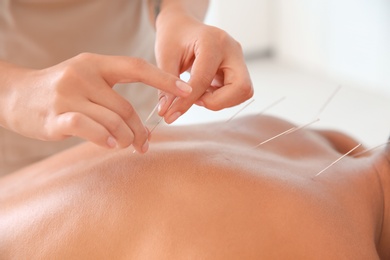 Photo of Young man undergoing acupuncture treatment in salon, closeup