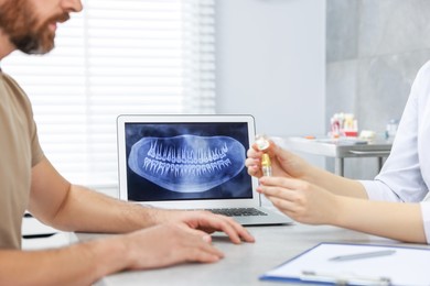 Doctor showing patient educational model of dental implant in clinic, closeup