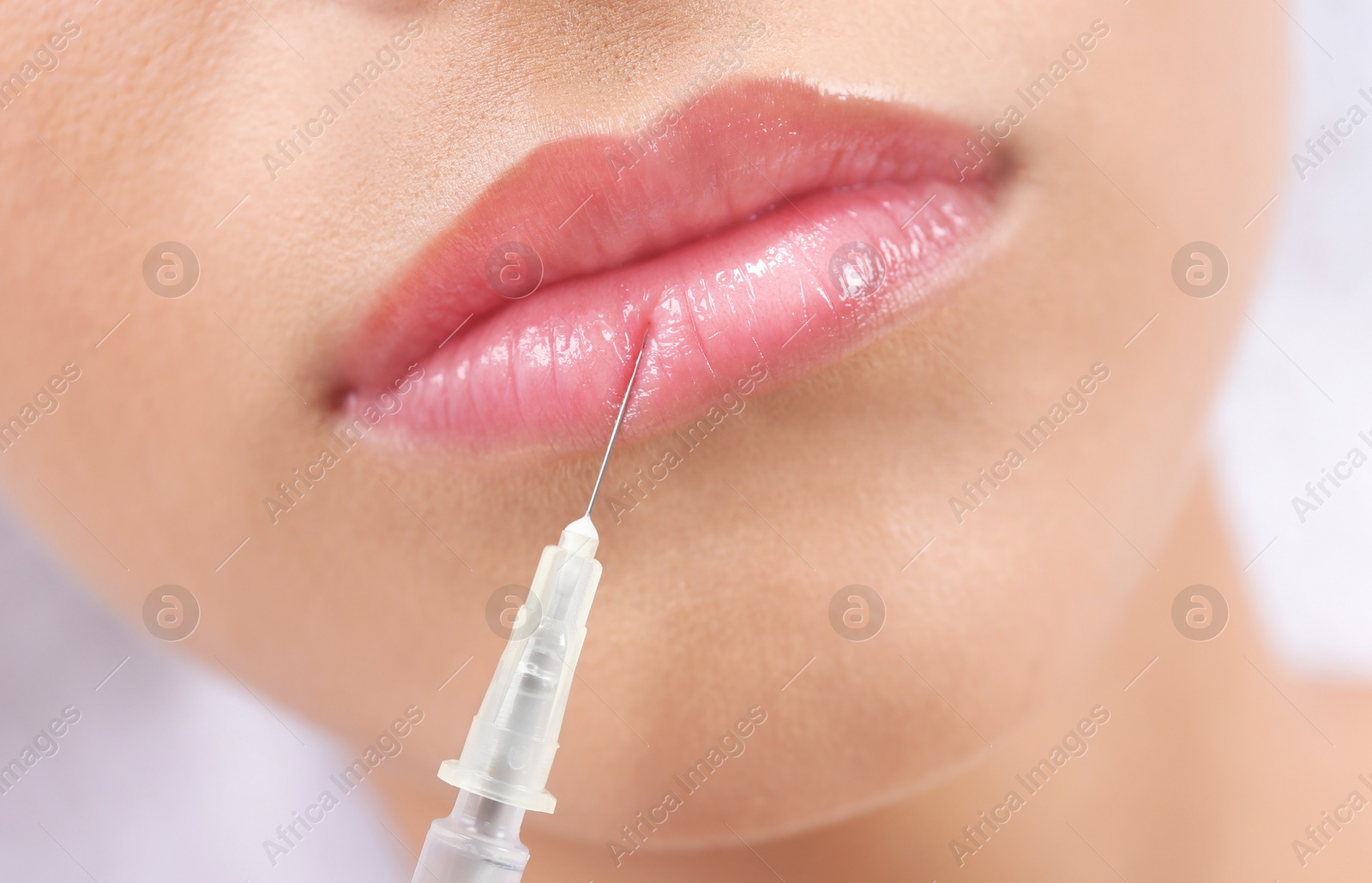 Photo of Young woman getting lip injection in beautician salon, closeup