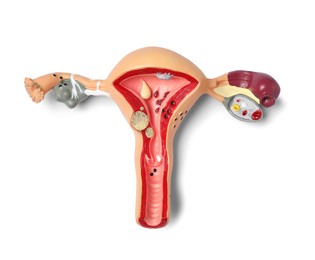 Photo of Model of female reproductive system isolated on white, top view. Gynecological care