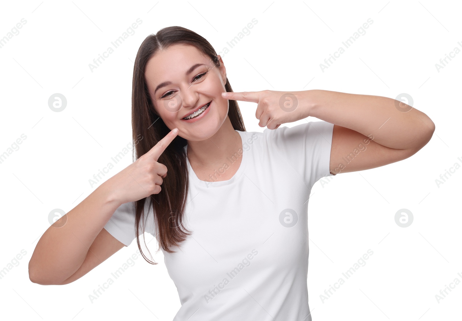 Photo of Smiling woman with dental braces on white background