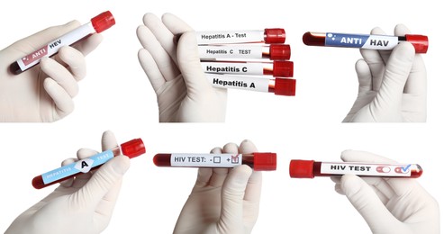 Image of Collage with photos of scientists holding test tubes with blood samples on white background, closeup