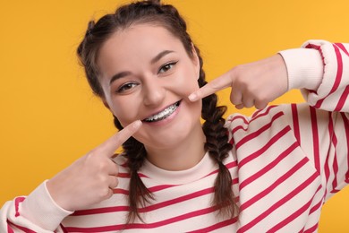 Photo of Happy woman pointing at braces on her teeth against orange background