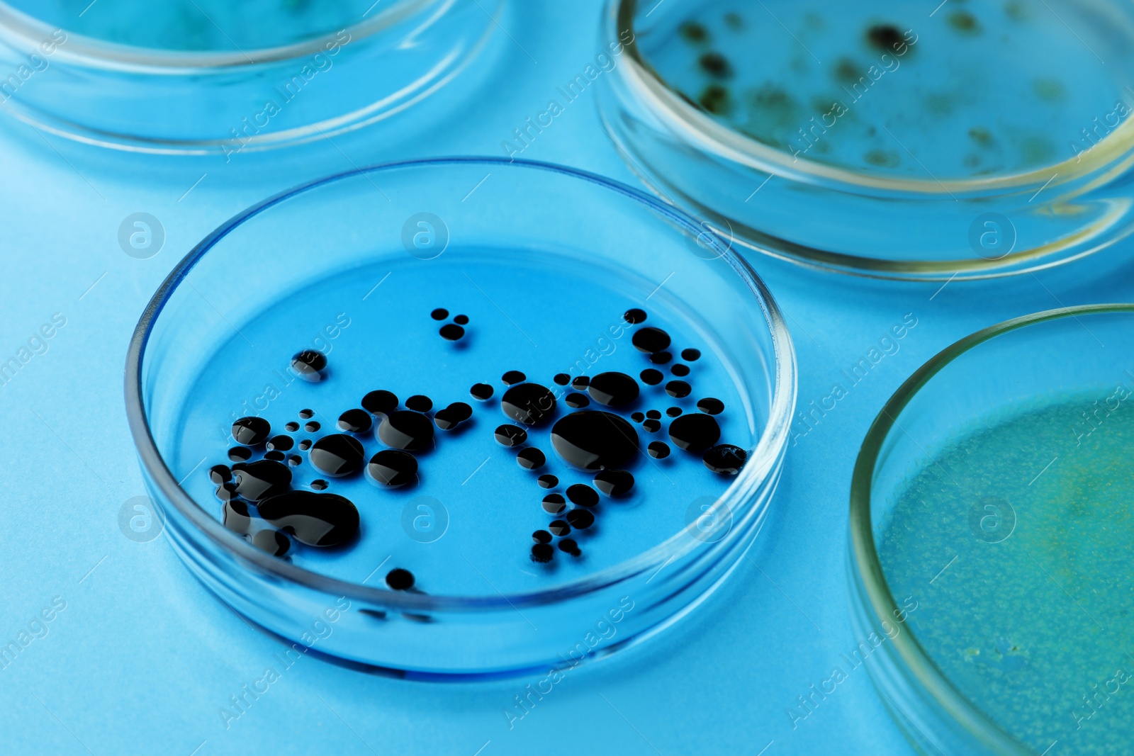 Photo of Petri dishes with different bacteria colonies on light blue background, closeup