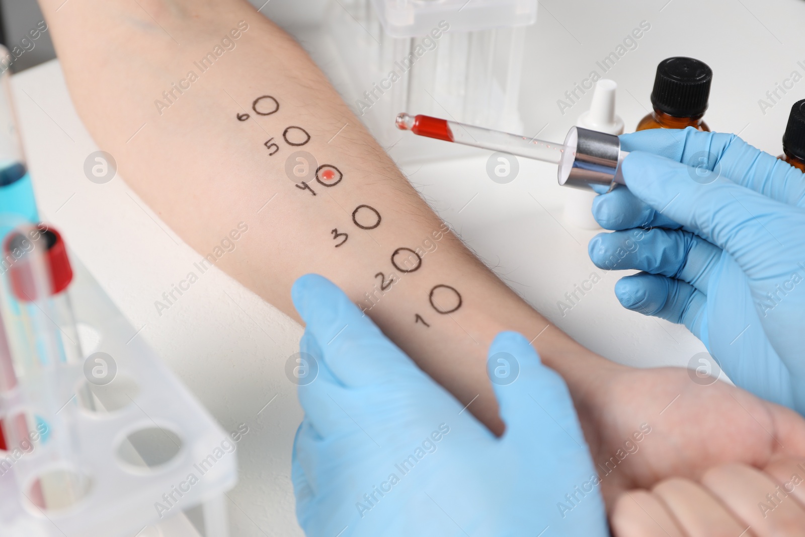 Photo of Doctor doing skin allergy test at light table, closeup