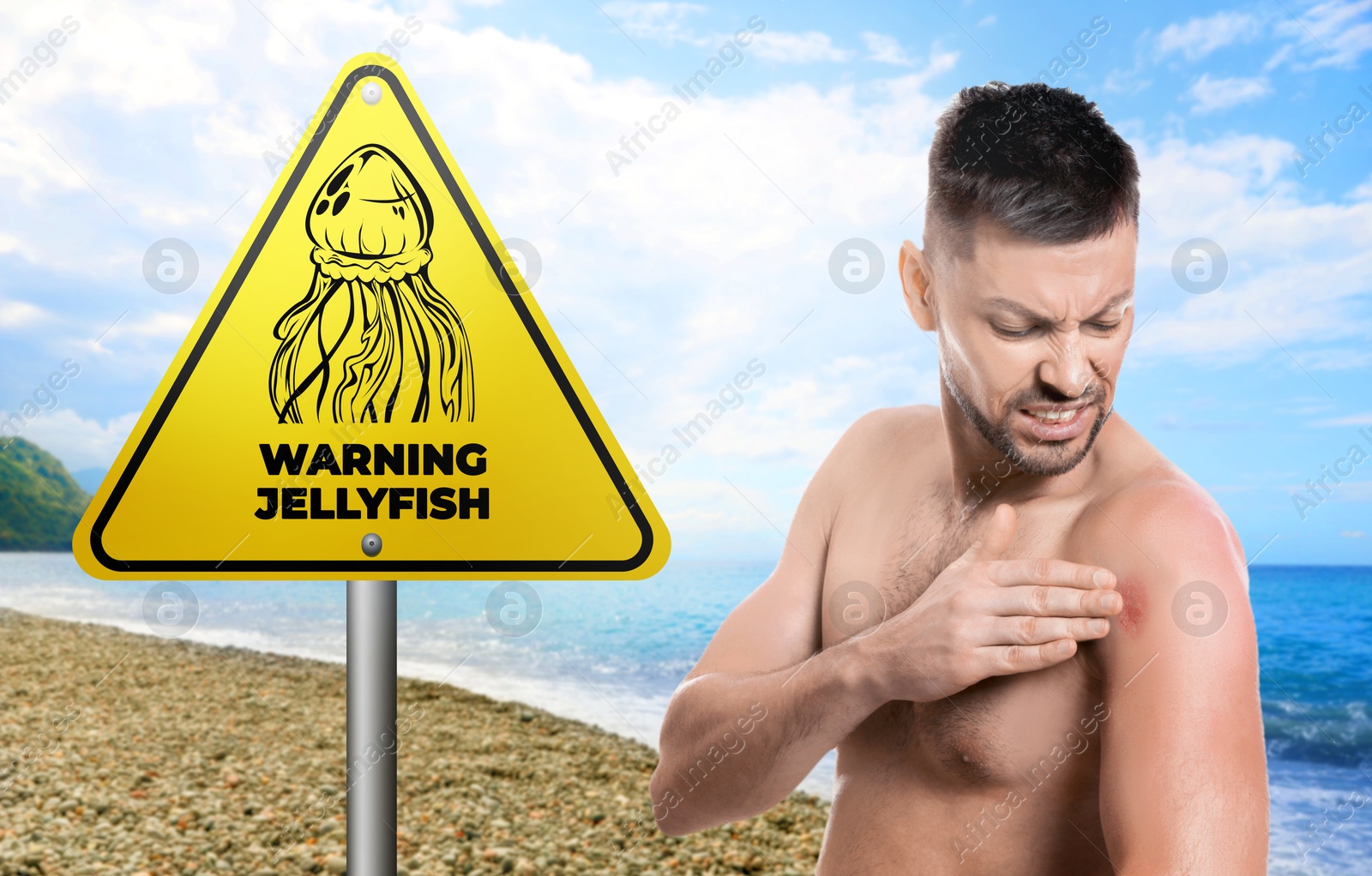 Image of Jellyfish warning sign and injured man on beach. Banner design