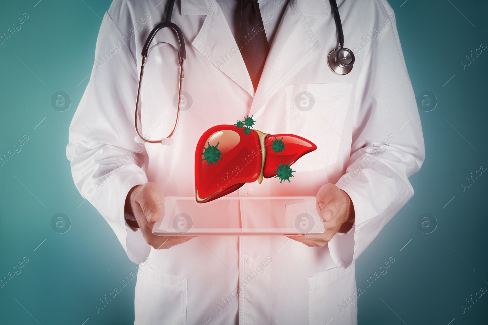 Image of Doctor with tablet and illustration of unhealthy liver on color background. Viral hepatitis