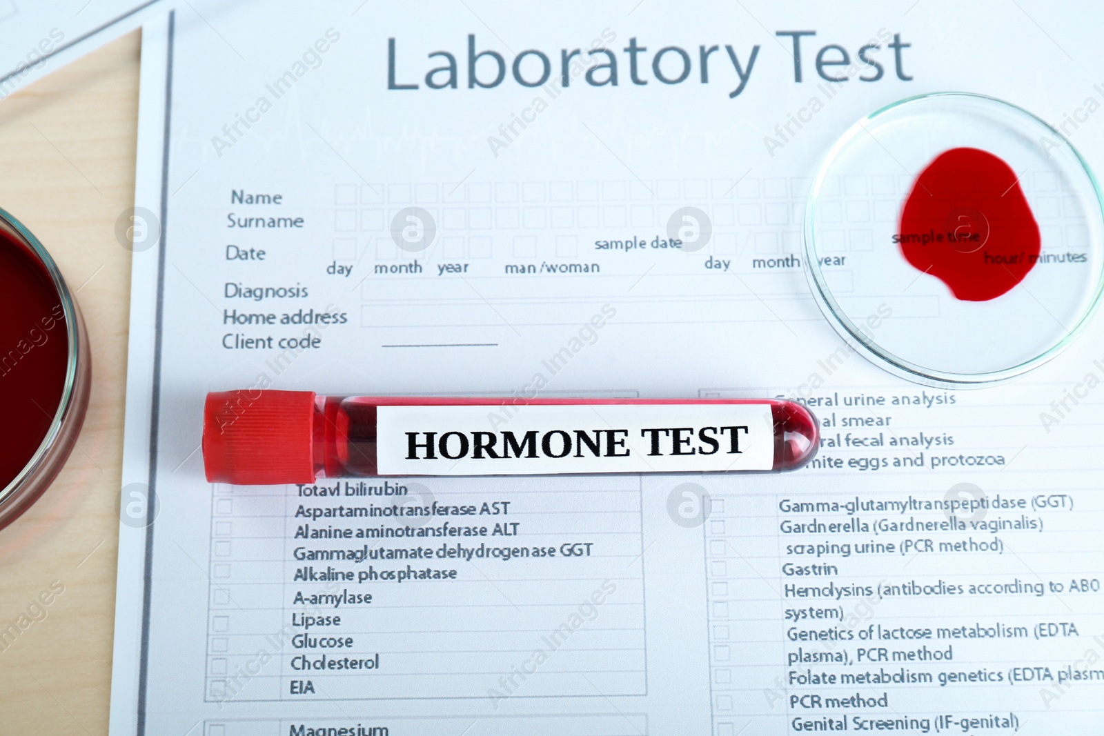 Photo of Hormone test. Sample tube with blood and laboratory form on table, flat lay