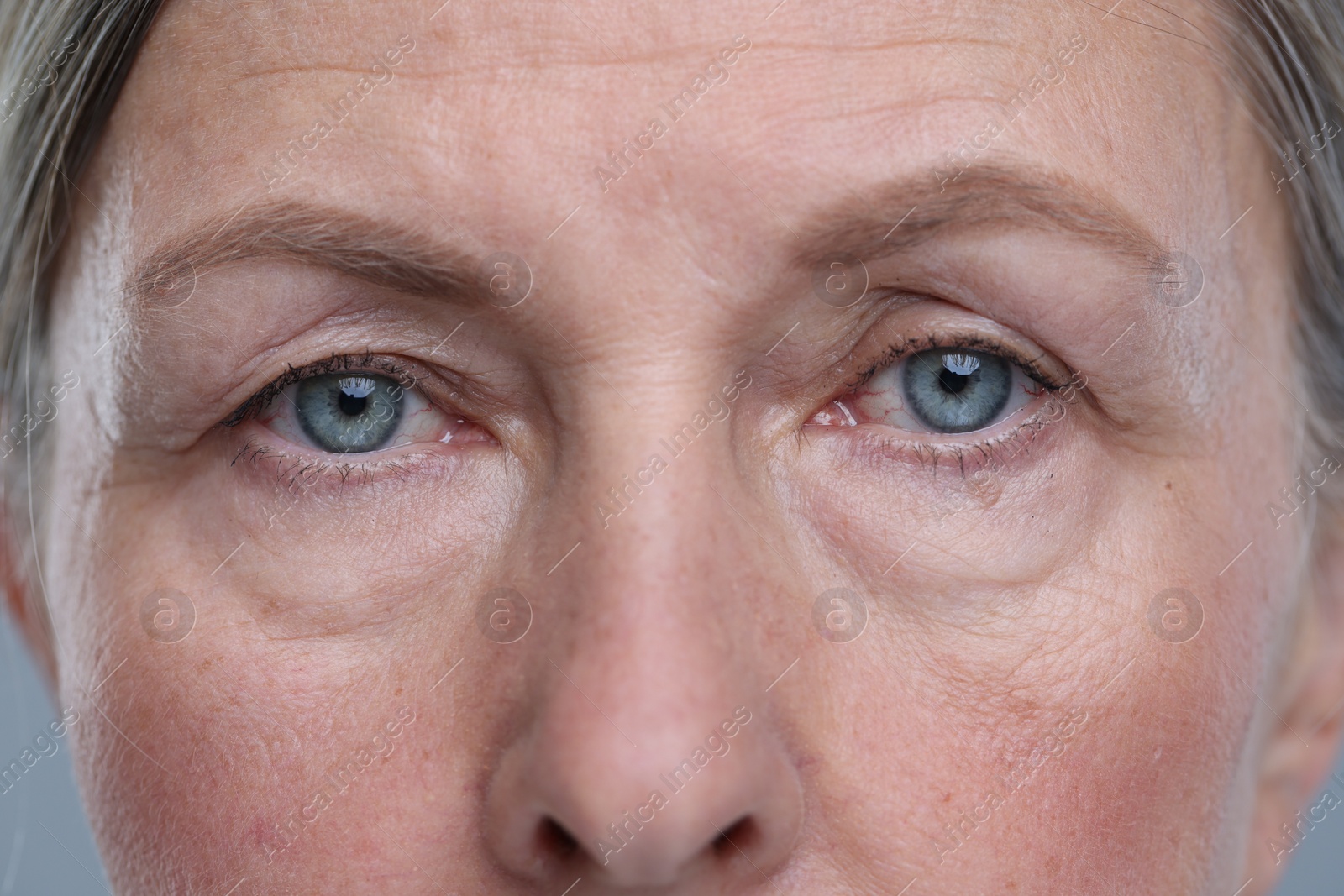 Photo of Senior woman with aging skin on grey background, closeup. Rejuvenation treatment