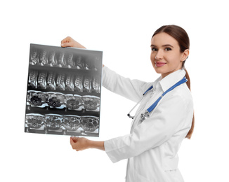 Photo of Orthopedist holding X-ray picture on white background