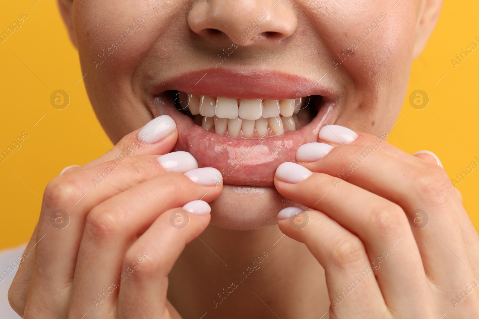 Photo of Woman showing her clean teeth on yellow background, closeup