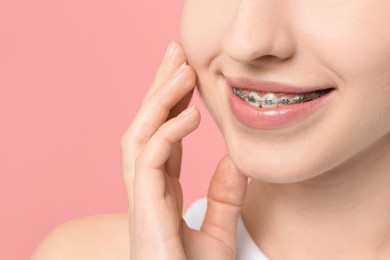 Photo of Smiling woman with dental braces on pink background, closeup. Space for text