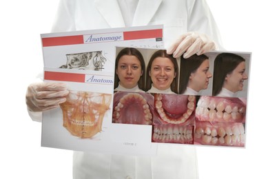 Doctor holding photo of woman and her teeth from different sides and visualization of human maxillofacial section for dental analysis printed on papers against white background, closeup