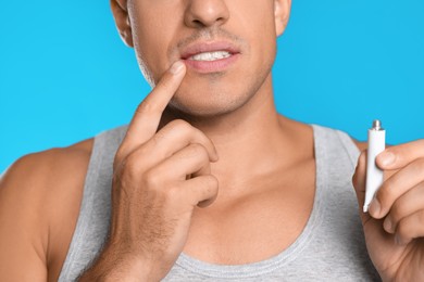 Photo of Man with herpes applying cream on lips against light blue background, closeup