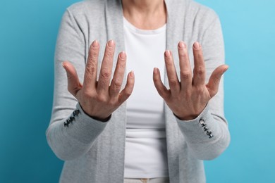 Photo of Arthritis symptoms. Woman suffering from pain in hands on light blue background, closeup