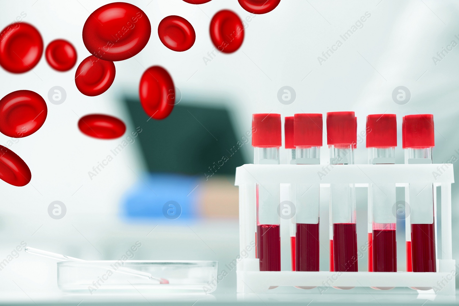 Image of Test tubes with blood samples in laboratory and illustration of erythrocytes