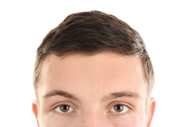 Young man with acne problem on white background