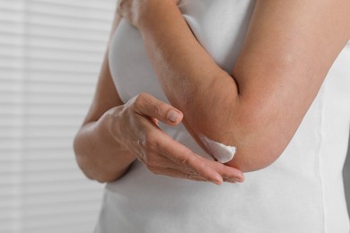 Woman applying body cream on elbow indoors, closeup