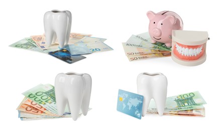 Image of Set with educational dental models and money on white background. Expensive teeth treatment
