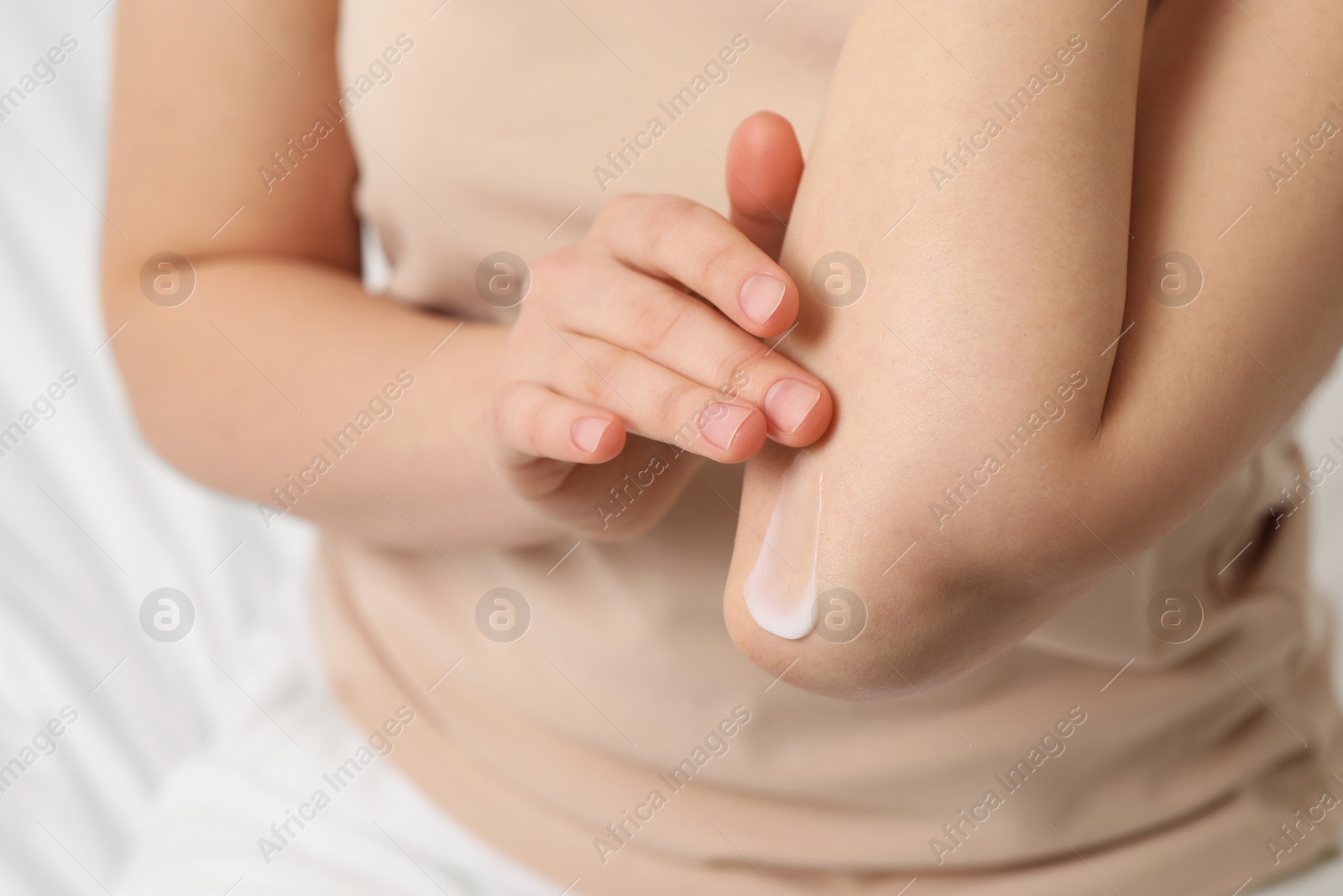 Photo of Young woman with dry skin applying cream onto her elbow on bed, closeup