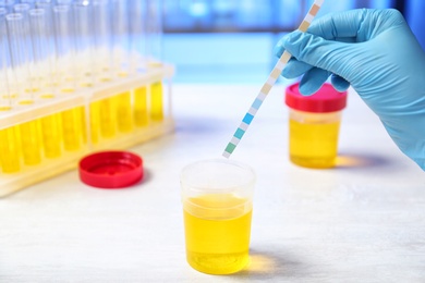 Photo of Laboratory assistant doing analysis with urine sample and litmus paper on table, closeup