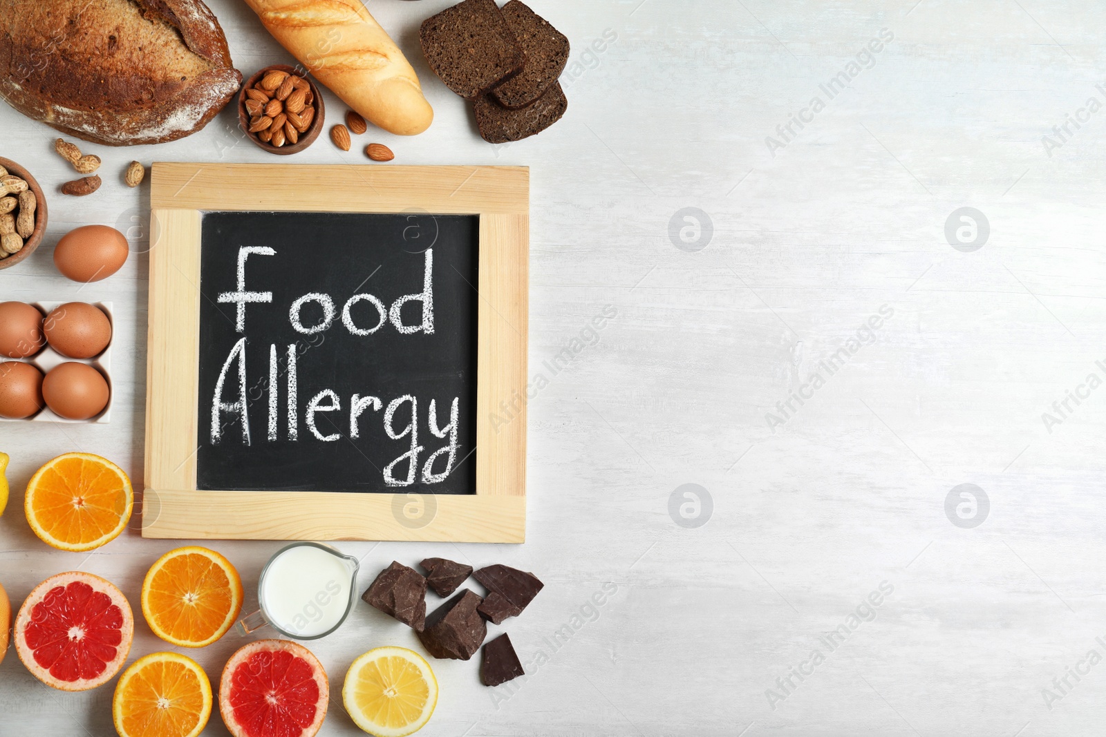 Photo of Chalkboard with words FOOD ALLERGY and different products on white table, flat lay. Space for text