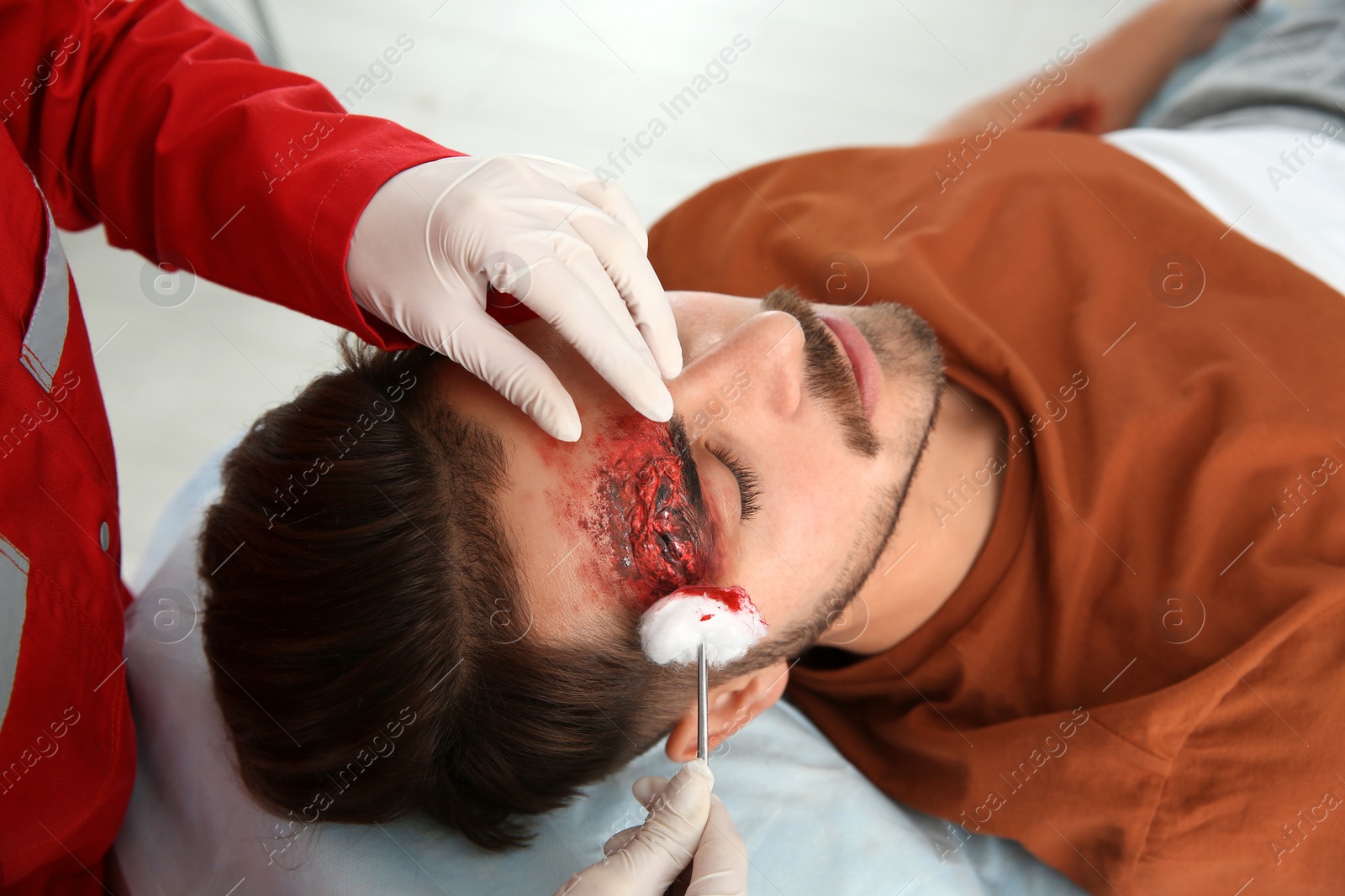 Photo of Nurse cleaning young man's head injury in clinic. First aid