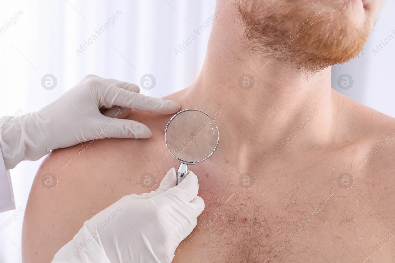 Photo of Dermatologist examining patient with magnifying glass in clinic, closeup view