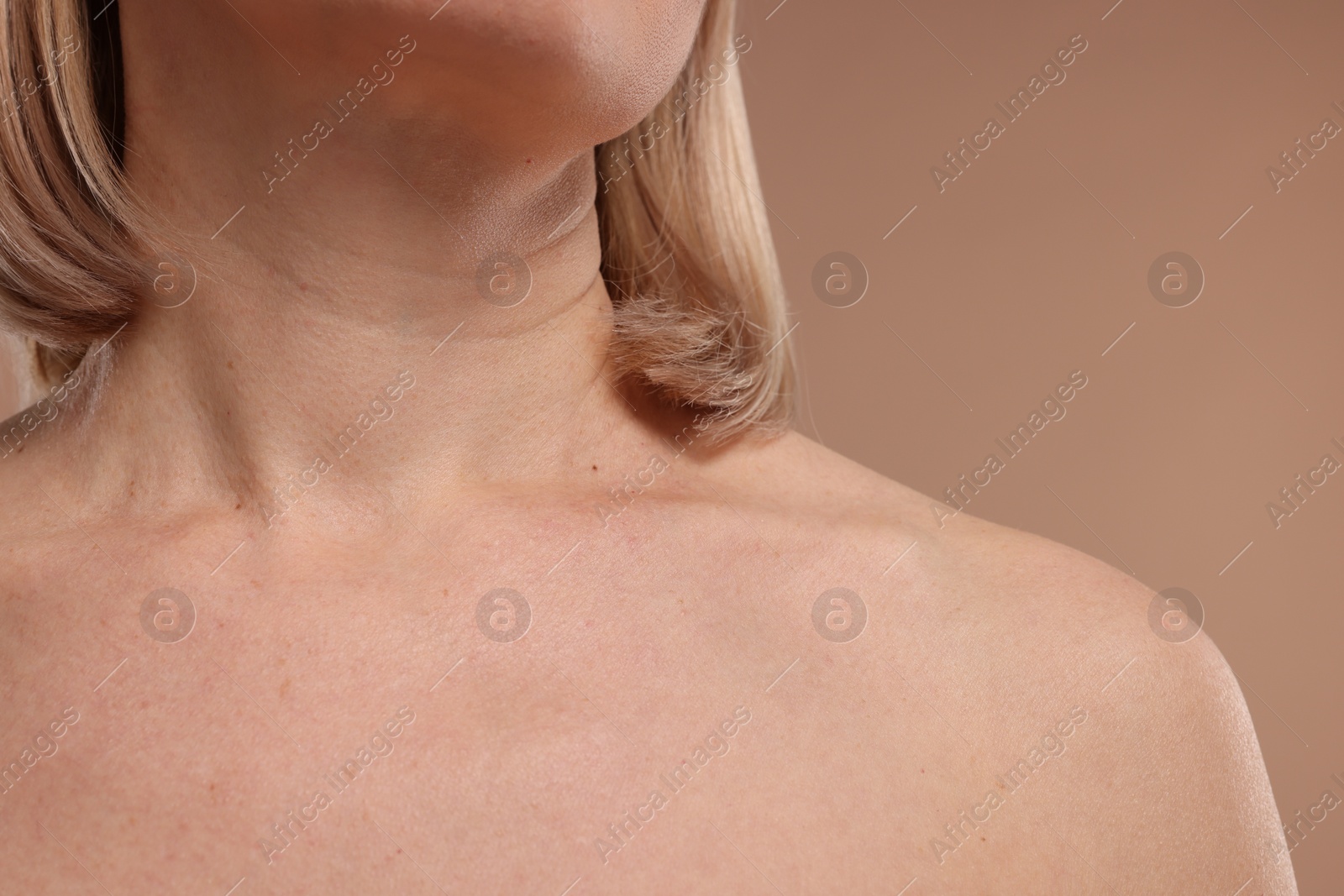 Photo of Woman with healthy skin on beige background, closeup