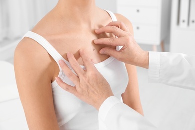 Photo of Dermatologist examining patient's birthmark in clinic, closeup