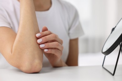 Photo of Woman with dry skin checking her arm indoors, closeup