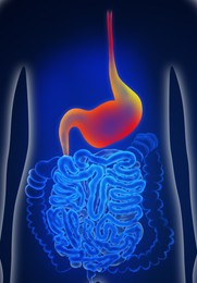 Illustration of  man suffering from stomach disease. Gastroenterology