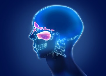 Illustration of X-ray picture of man showing progressing sinusitis in nasal cavities on blue background, illustration