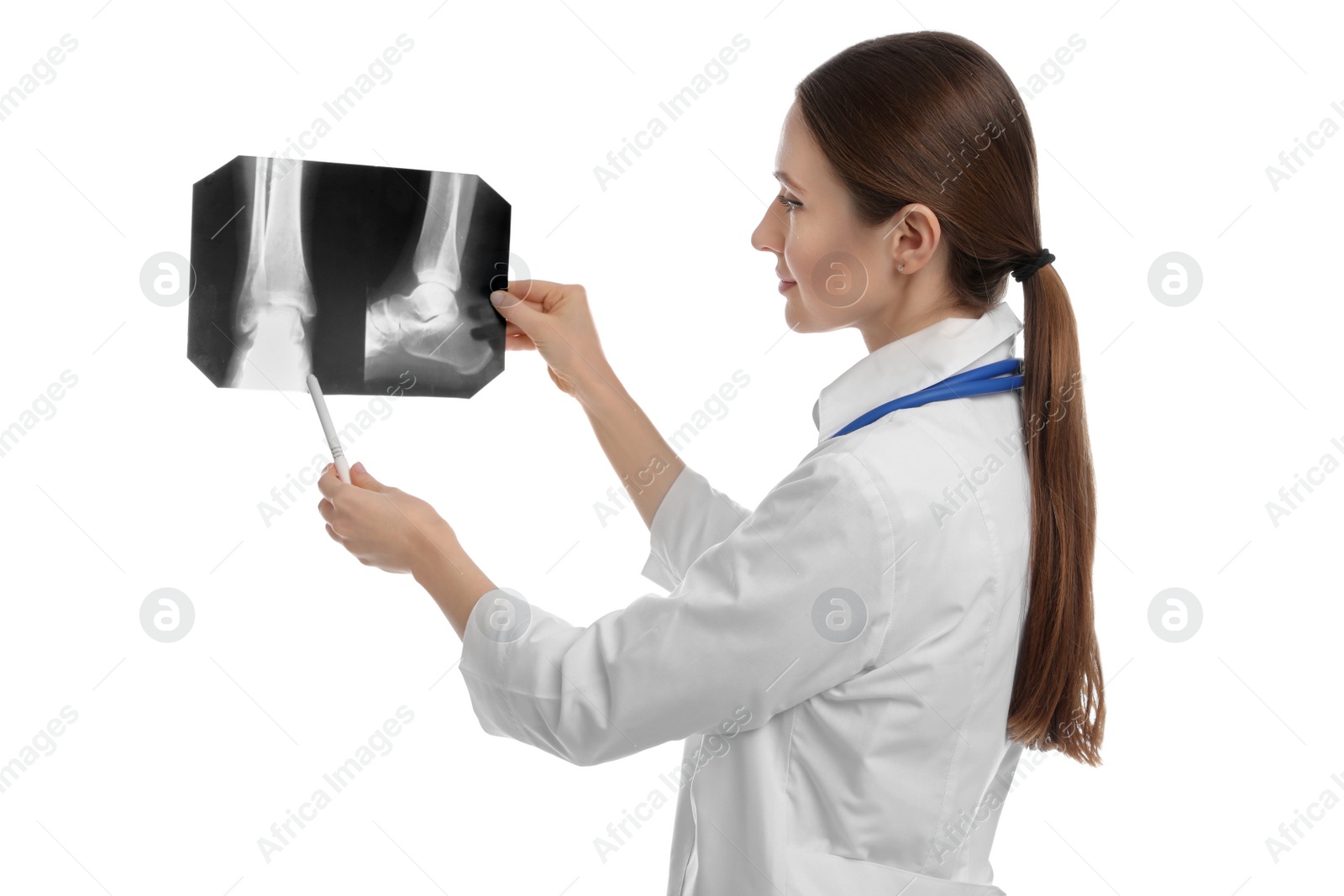 Photo of Orthopedist holding X-ray picture on white background