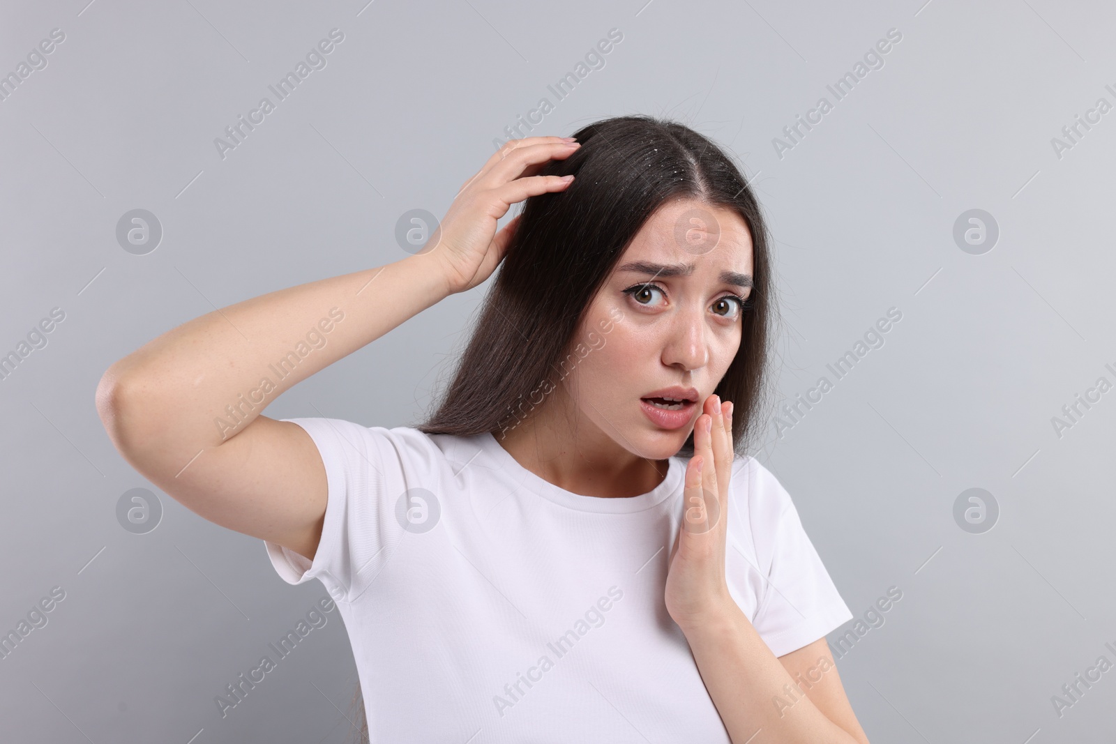 Photo of Emotional woman suffering from dandruff problem on grey background