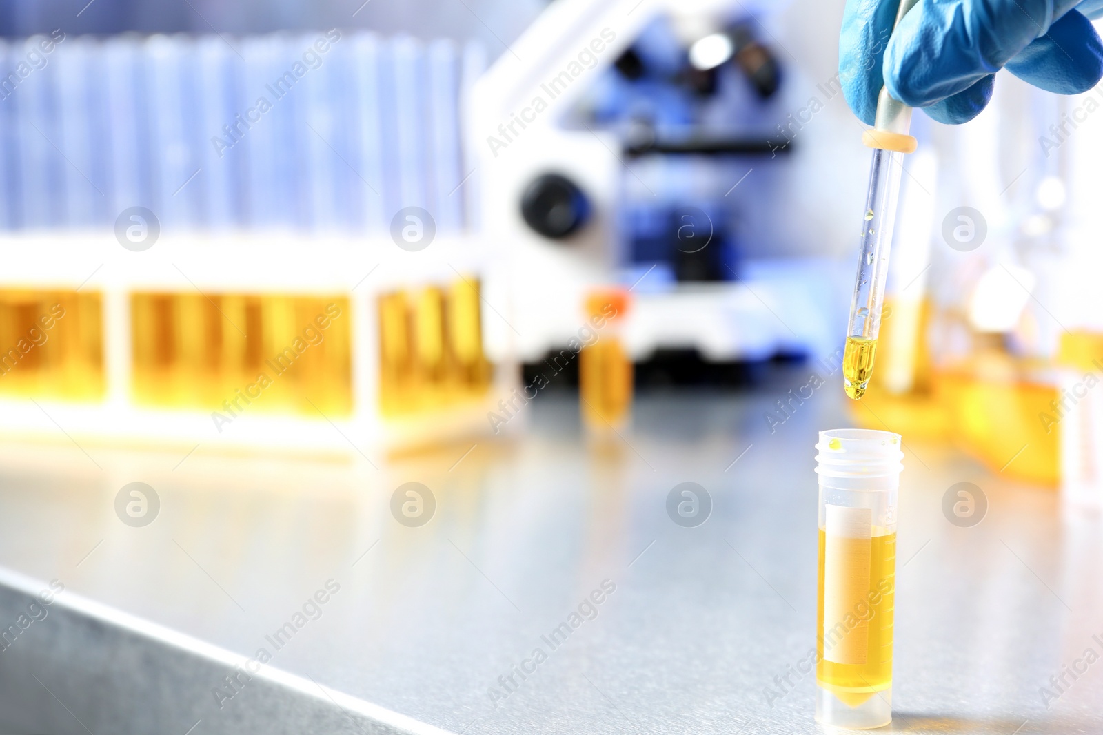 Photo of Laboratory assistant dripping urine sample from pipette into container on table, closeup with space for text. Medical analysis