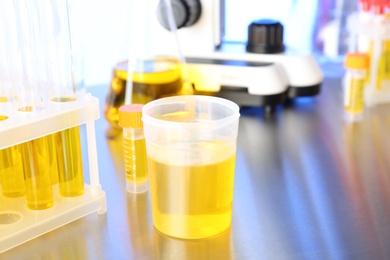 Photo of Laboratory ware with samples for urine analysis on table
