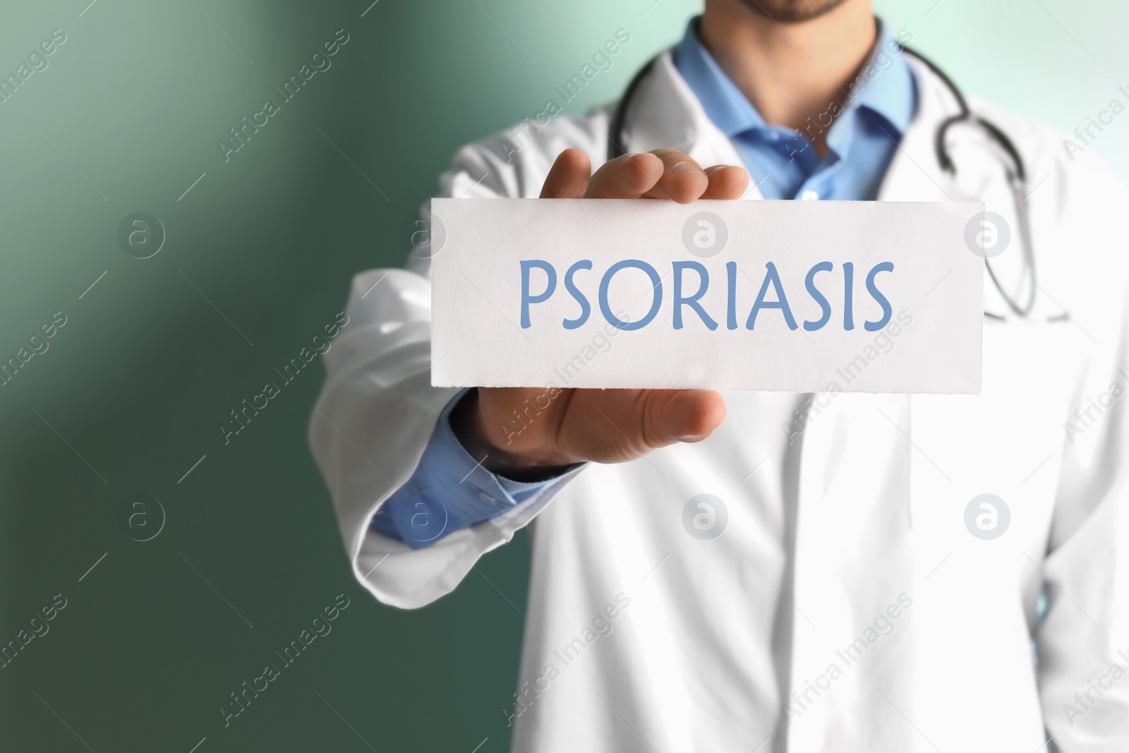 Image of Doctor holding sign with word PSORIASIS on color background, closeup