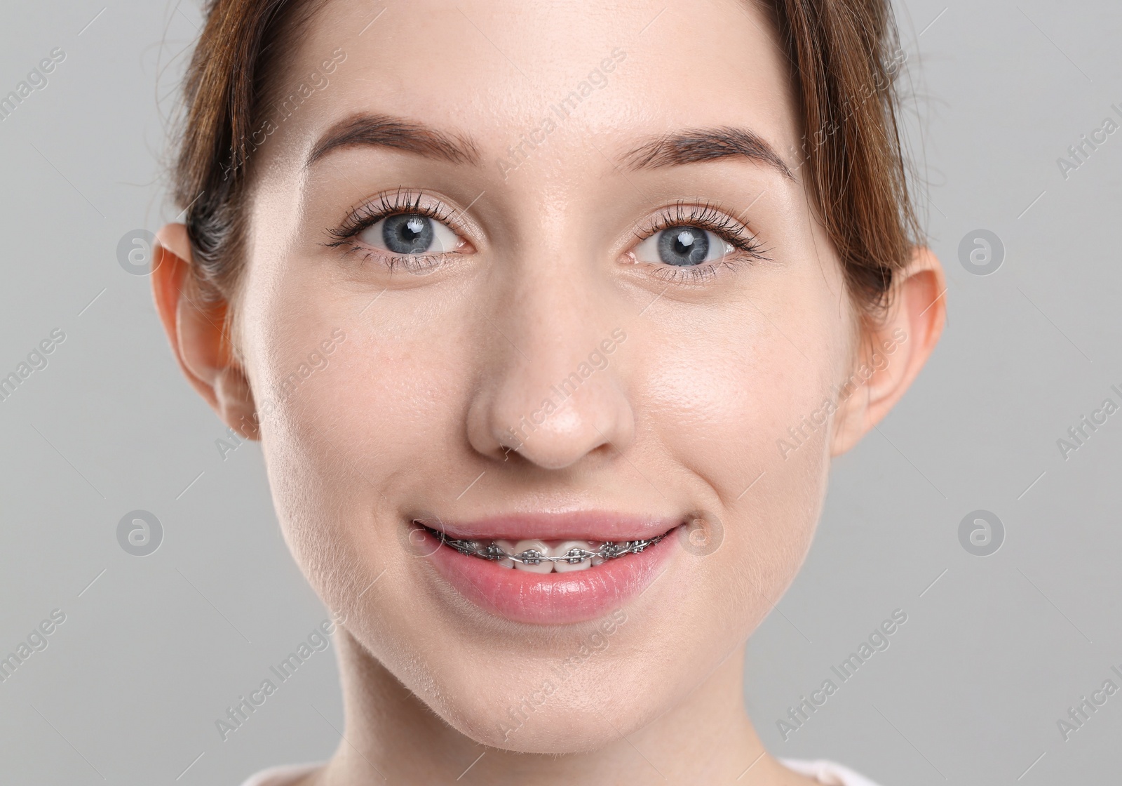 Photo of Smiling woman with dental braces on grey background, closeup