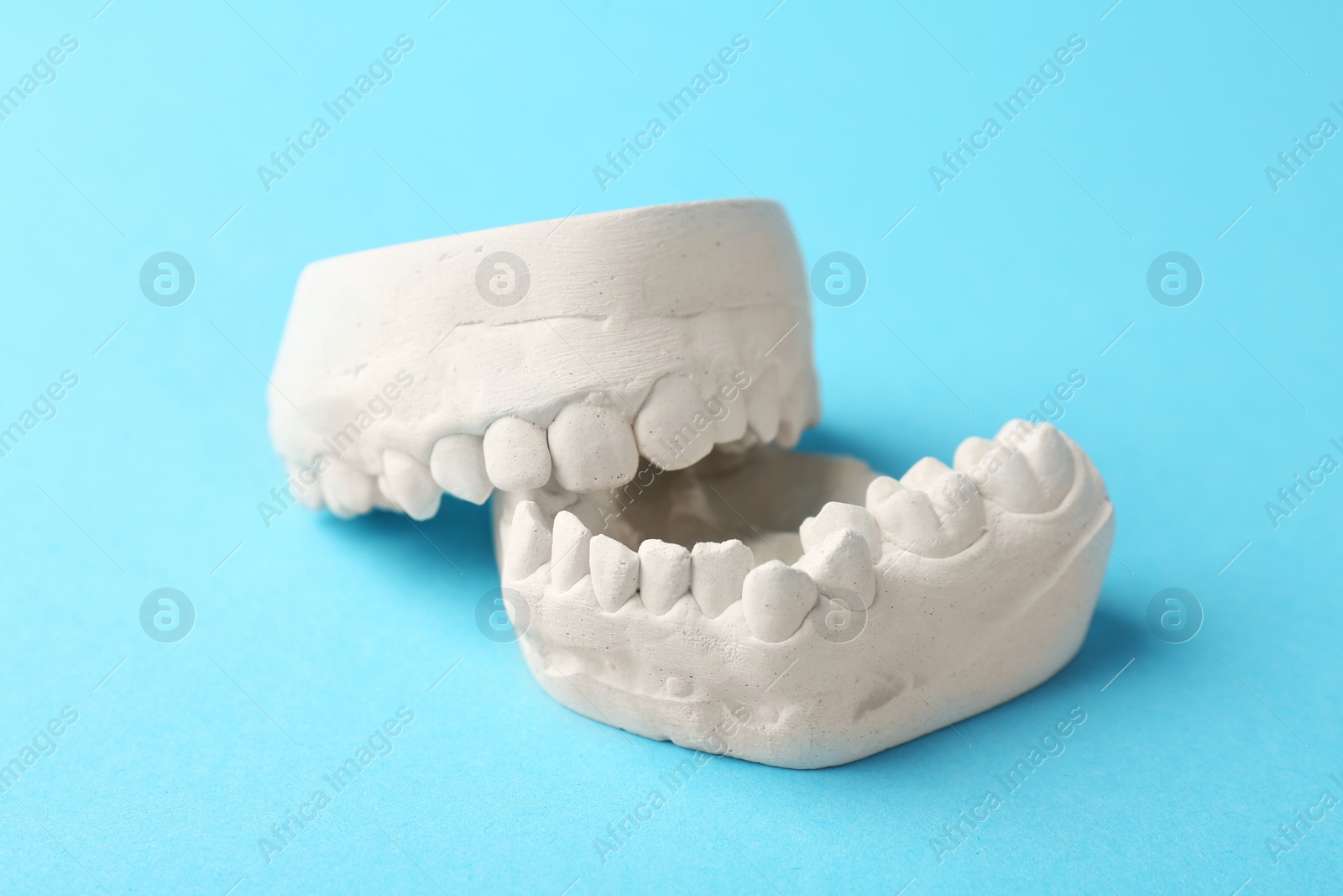 Photo of Dental model with gums on light blue background. Cast of teeth