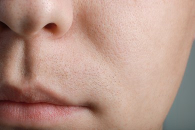 Photo of Closeup view of man with healthy skin on light grey background